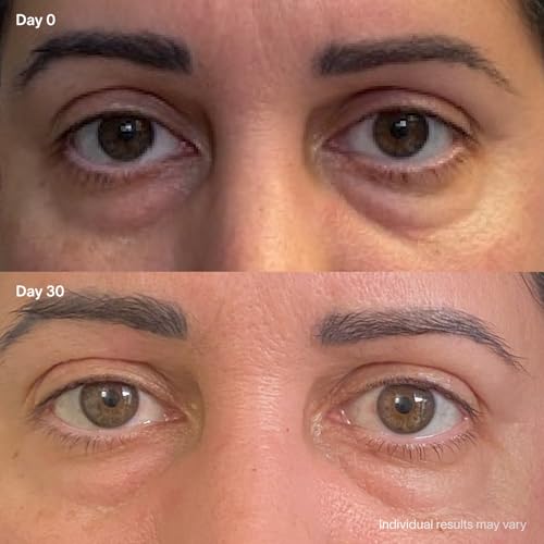 Red Light Eye Mask - LED with Amber