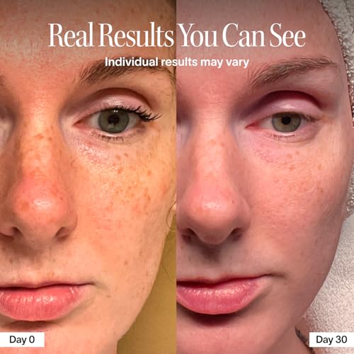 Red Light Therapy Face Mask And LightBoost Face & Neck Serum Kit
