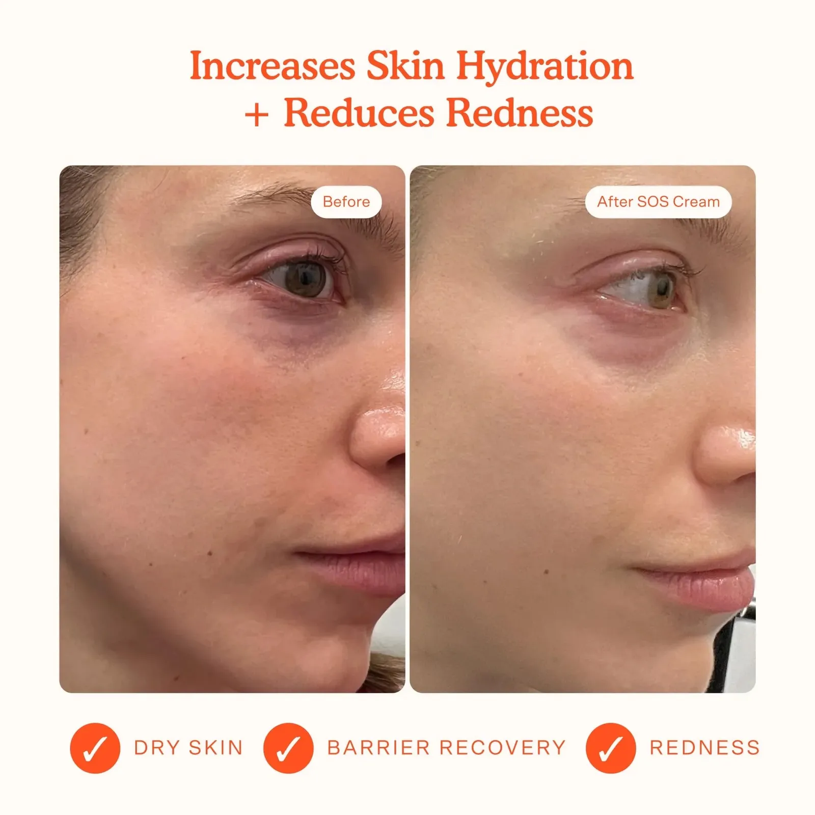 Daily Skin Barrier Redness Recovery Moisturizer 1.86 oz