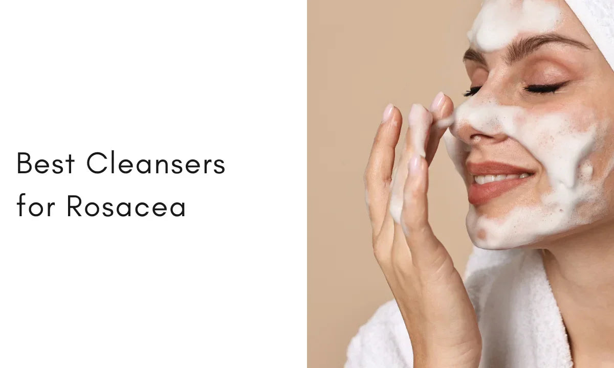 10 Cleansers for Rosacea That Pass the Sensitivity Test