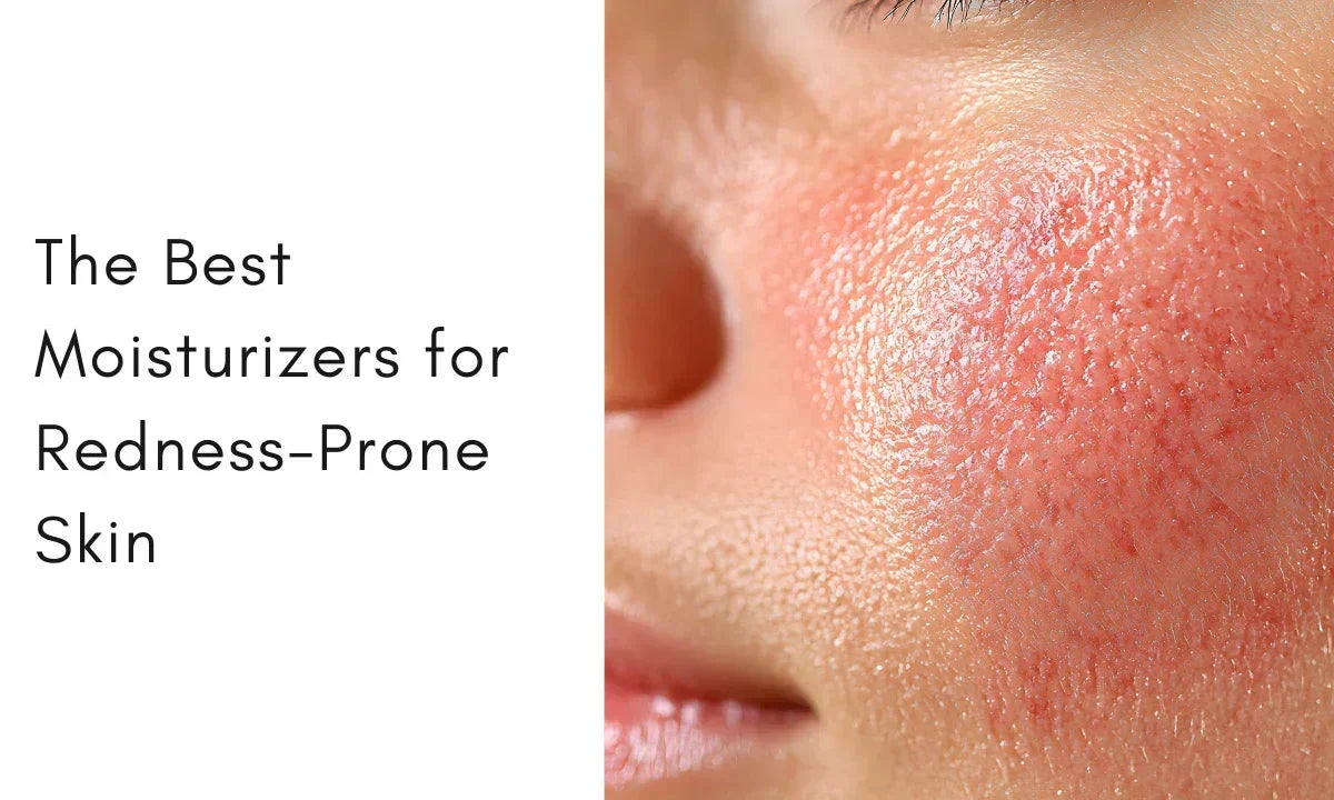 9 Best Moisturizers for Redness and Irritated Skin