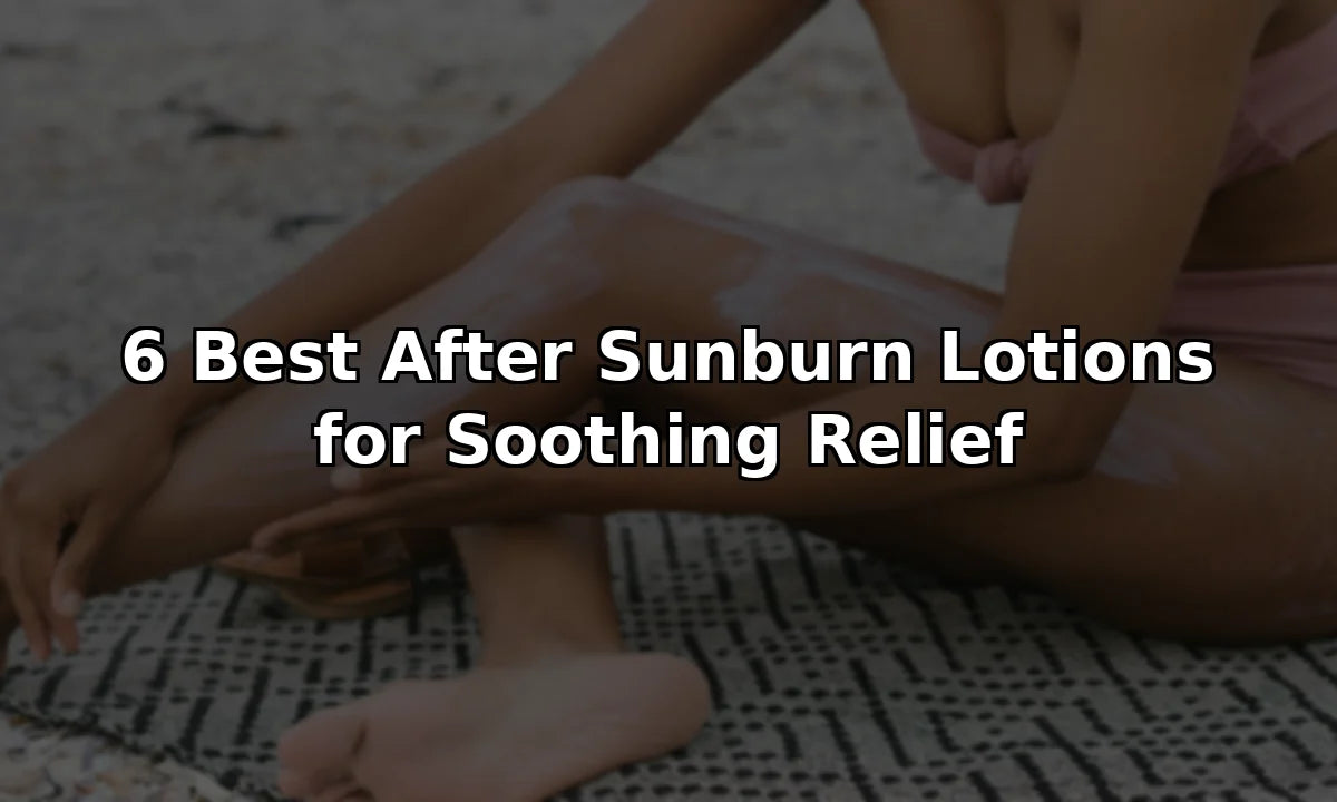 6 Best After Sunburn Lotions for Soothing Relief