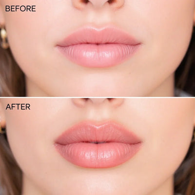Ashunta Sheriff Beauty Glow Lift Lip Plumper - Image 3