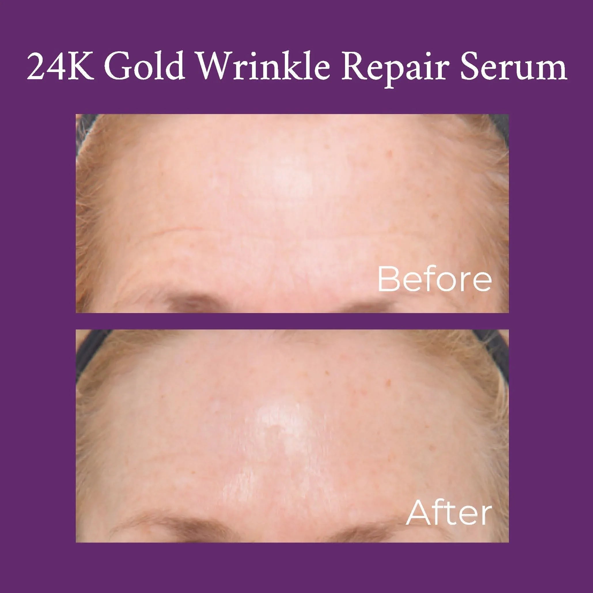 PRAI Beauty 24K Gold Caviar Wrinkle Repair Serum