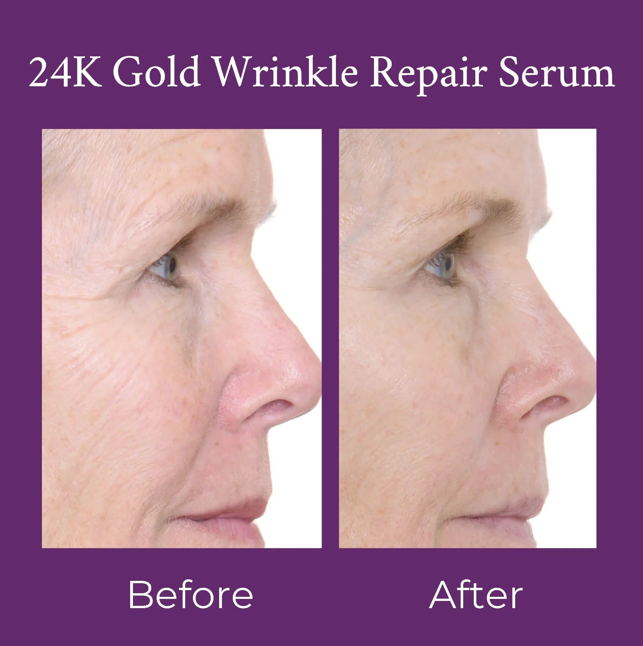 PRAI Beauty 24K Gold Caviar Wrinkle Repair Serum