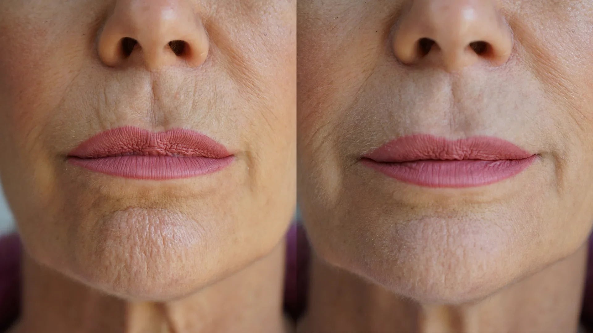 PRAI Beauty Ageless Lip & Line Filler