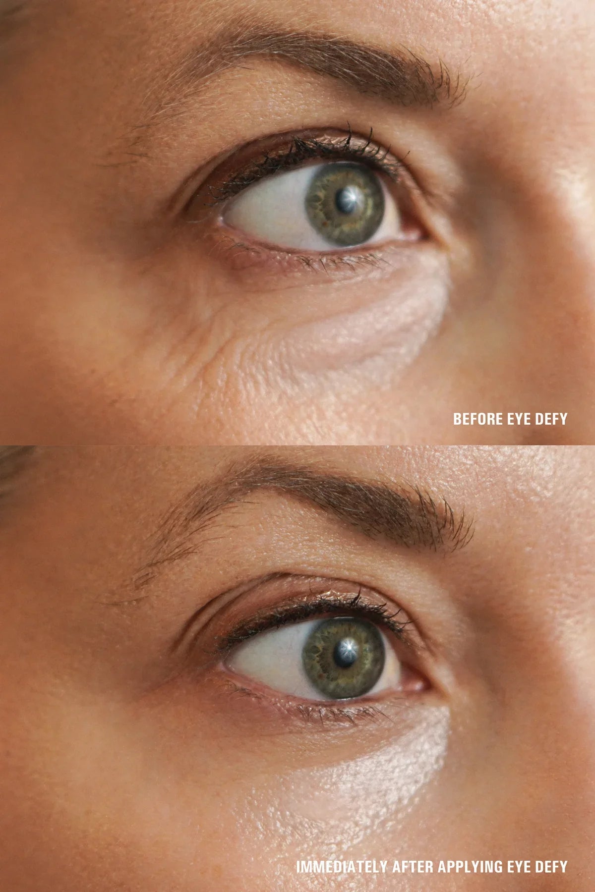 Goldfaden MD Eye Defy