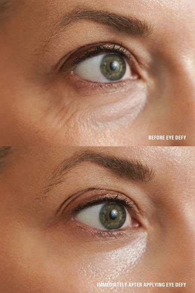 Goldfaden MD Eye Defy - Image 4