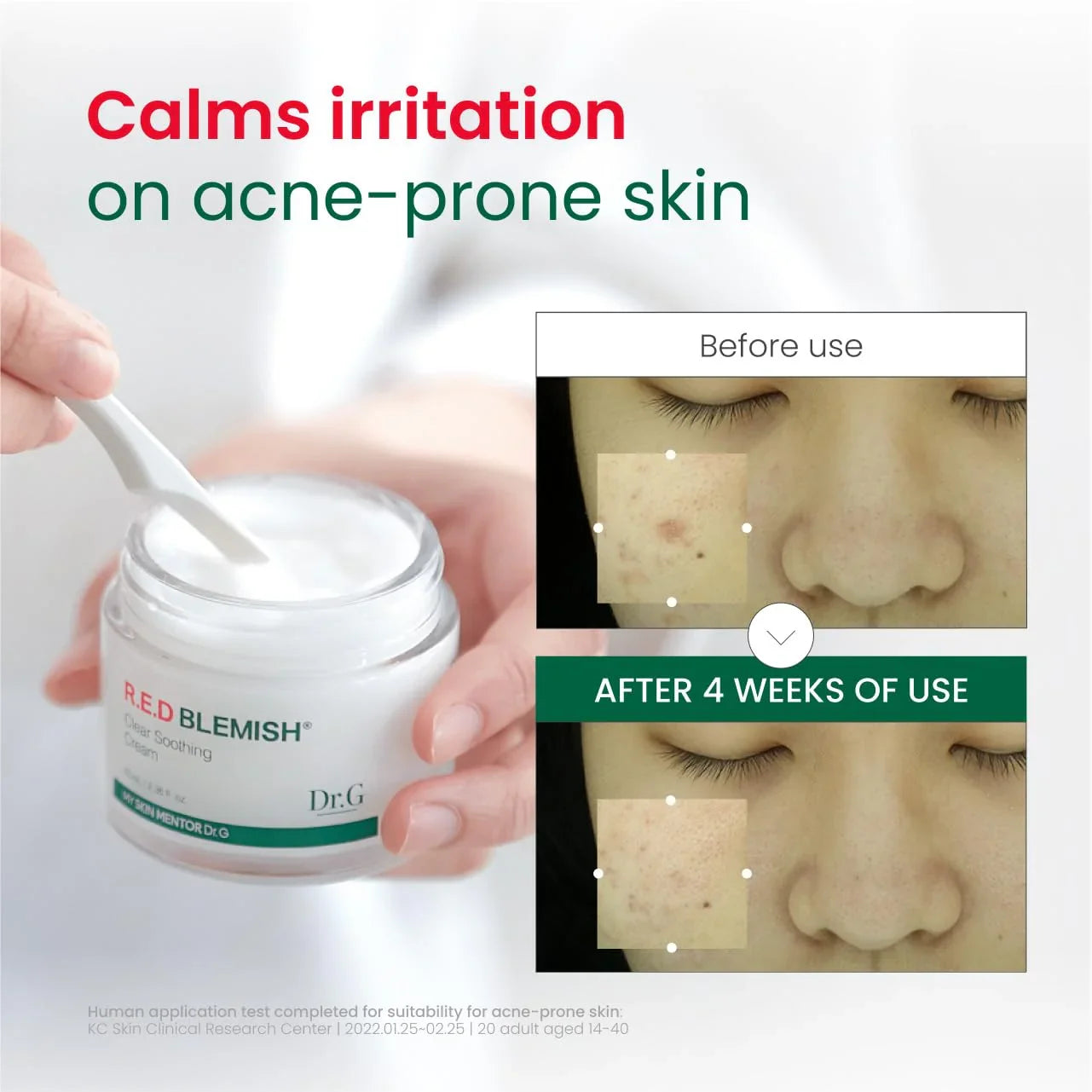 Dr.G R.E.D. Blemish Clear Soothing Cream - Calming Korean Moisturizer for Redness