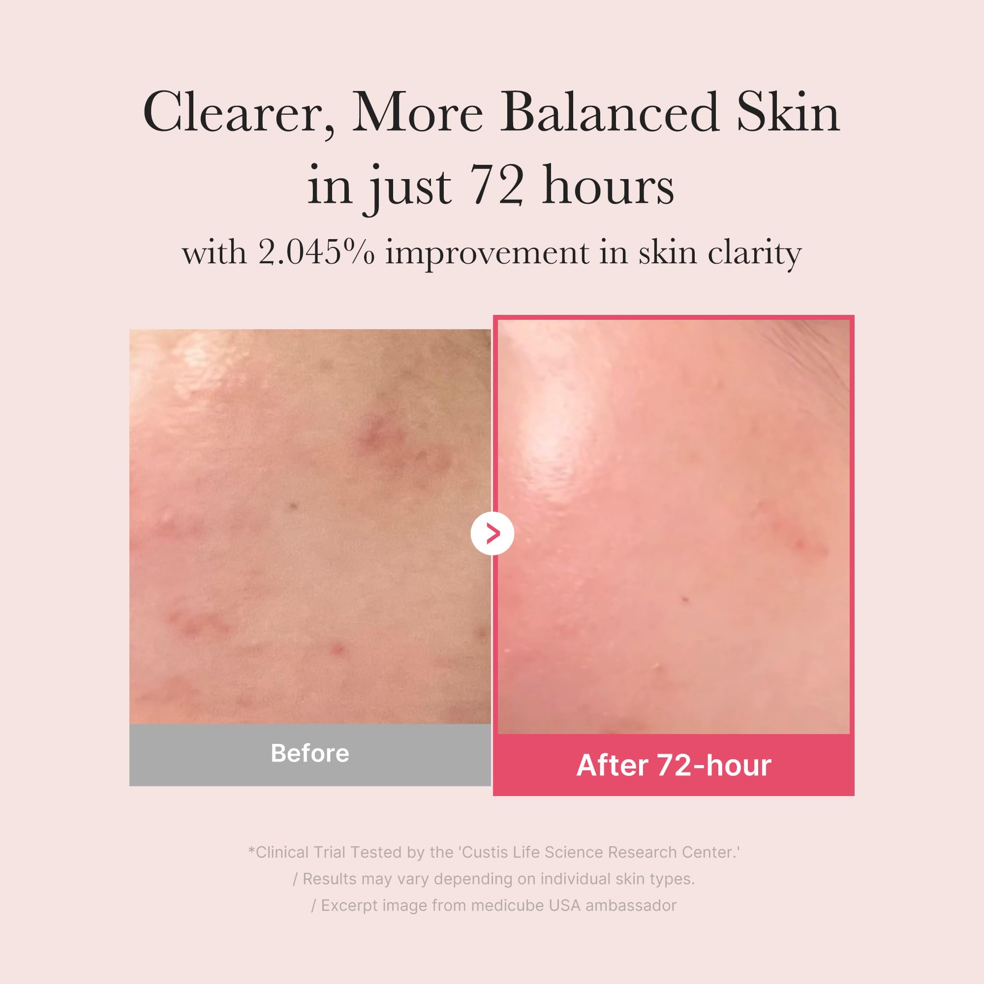 medicube TXA Niacinamide Facial Serum