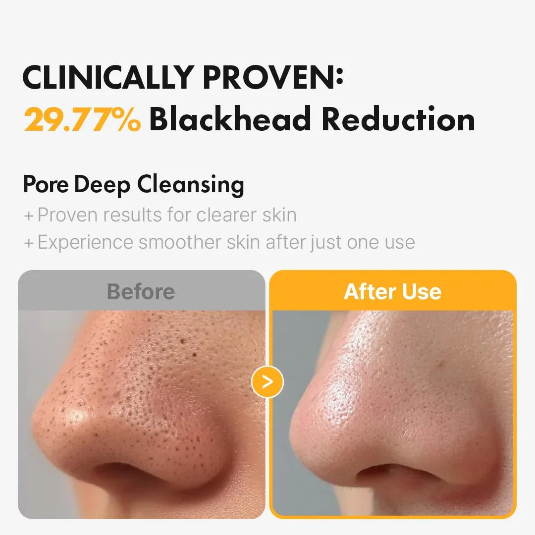 Hanskin Pore Cleansing Oil