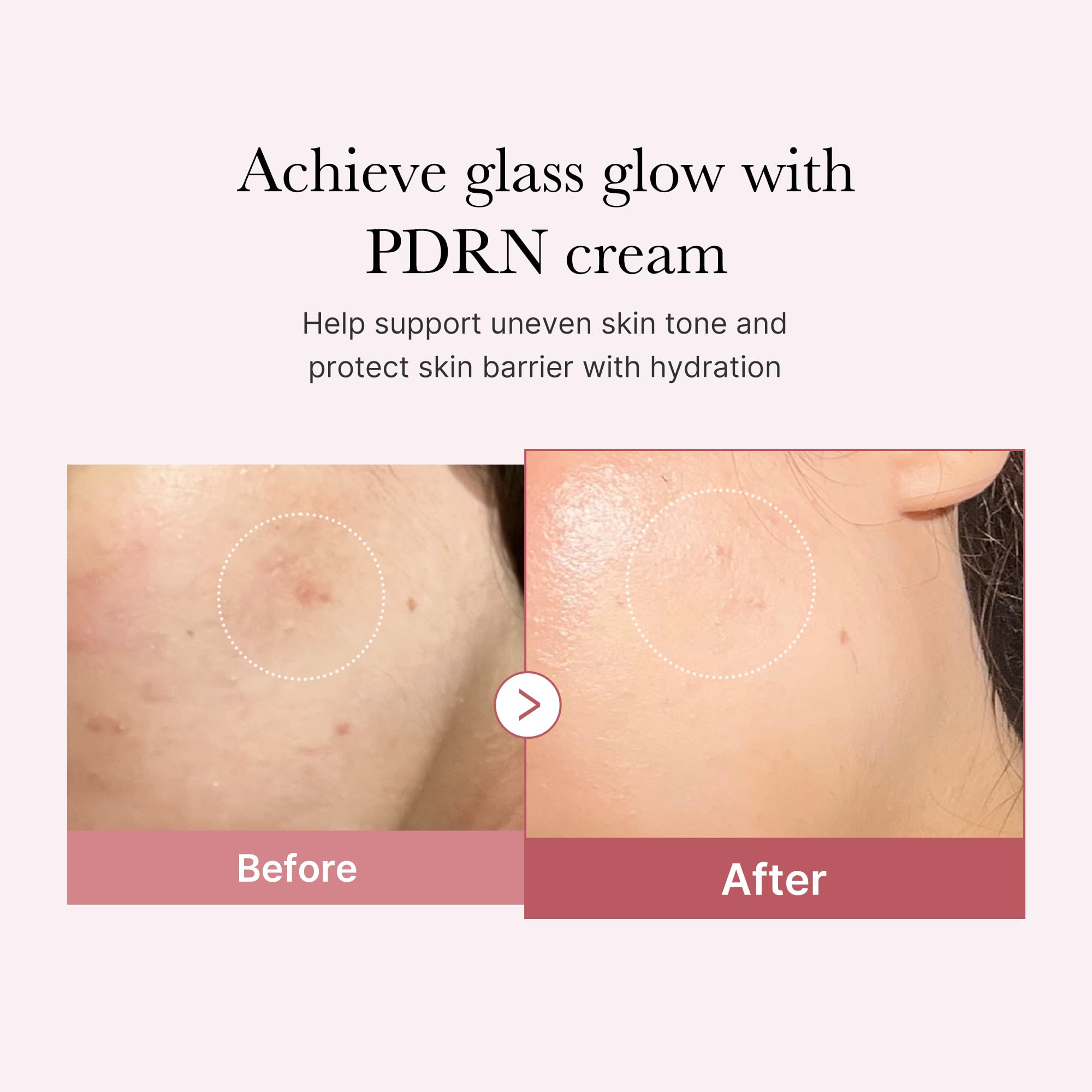 medicube PDRN Pink Hyaluronic Moisturizing Cream