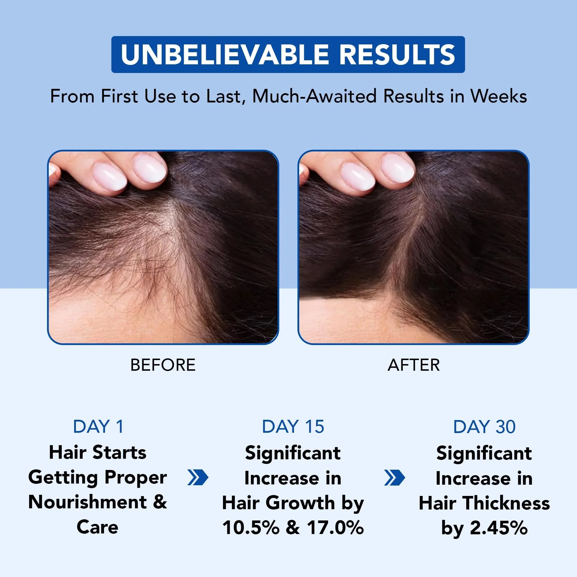 Botanic Hearth Rosemary Oil for Hair Growth