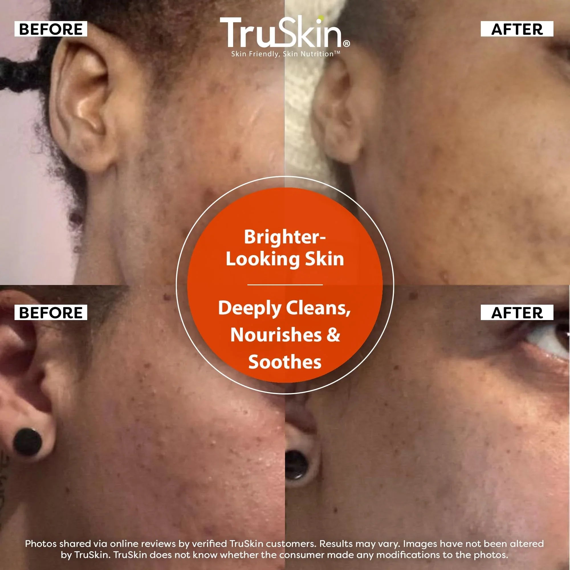 TruSkin Vitamin C Face Cleanser with Vitamins C & E, Rosehip Oil, Aloe Vera 5 fl oz