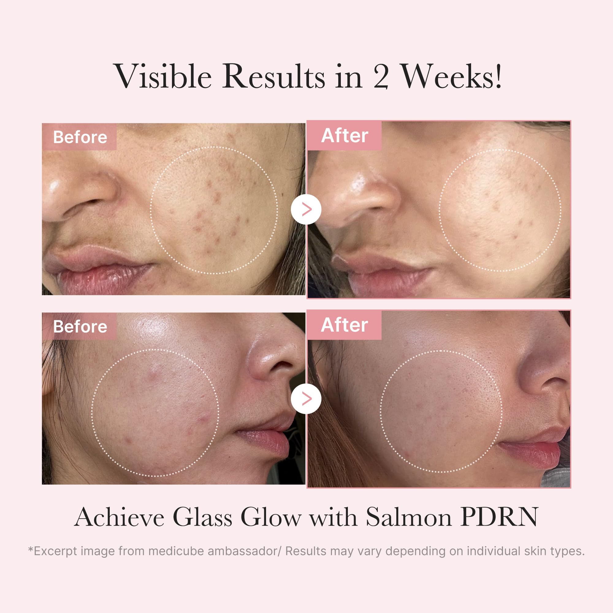 medicube Salmon DNA PDRN Trial Kit
