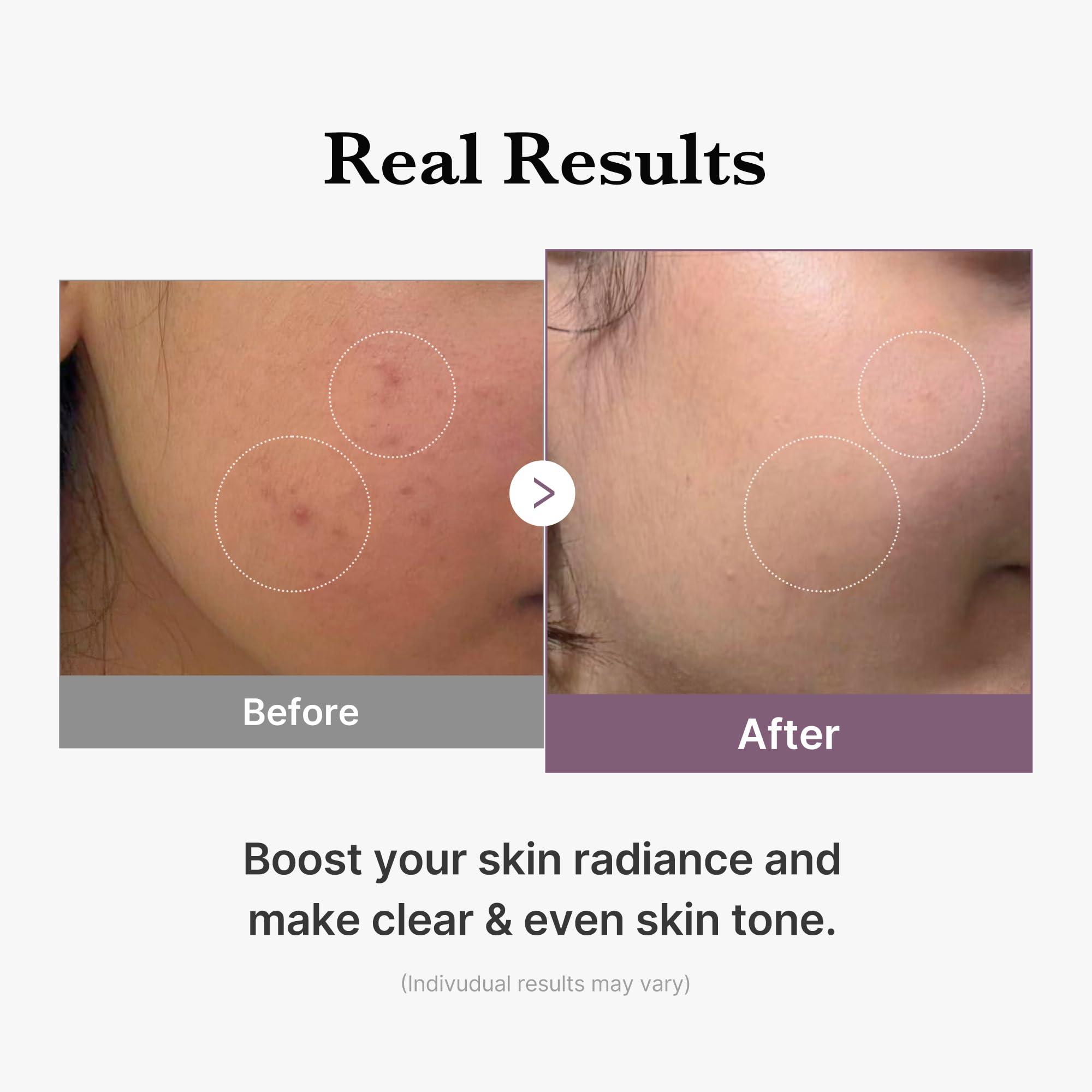 medicube Glutathione Glow Milky Toner