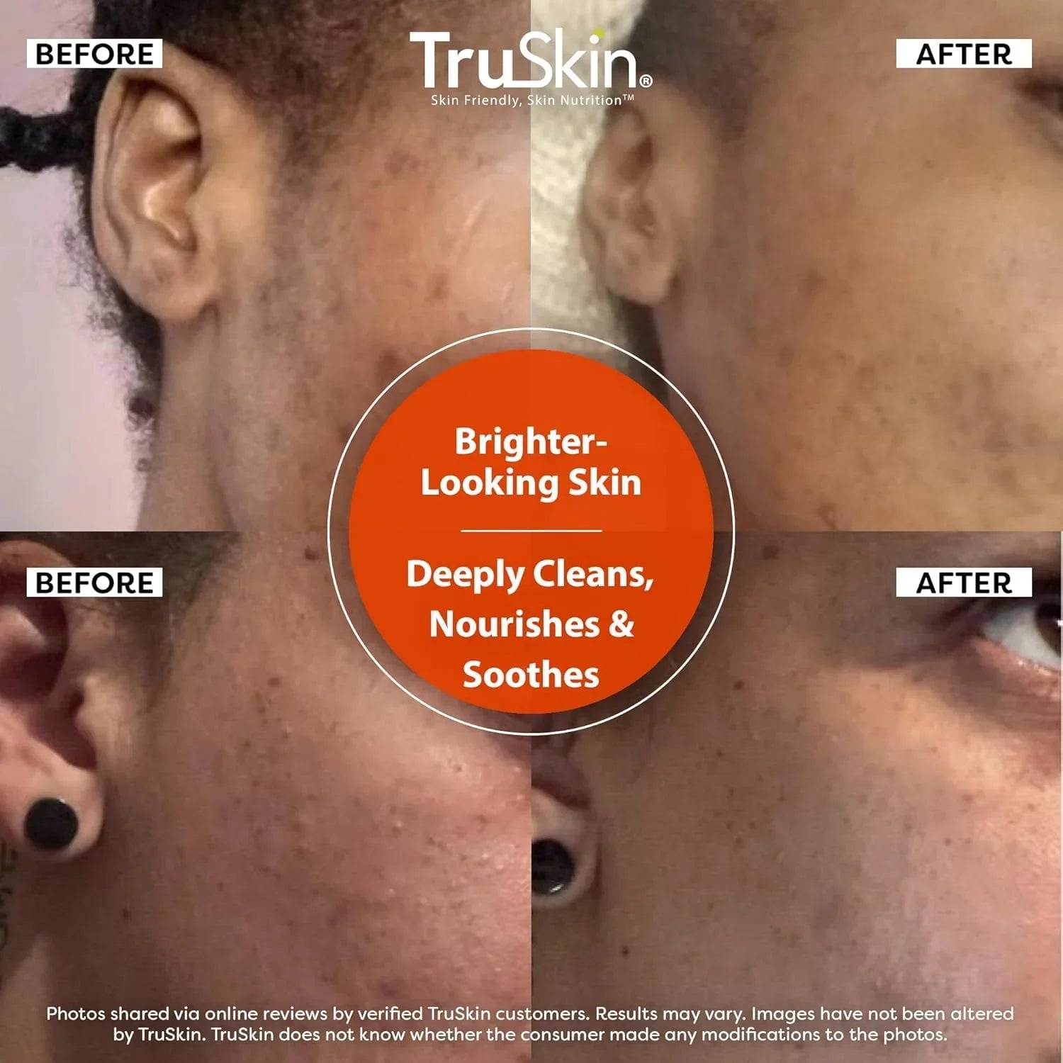 TruSkin Vitamin C Cleanser Face Wash with Vitamins C & E, Rosehip Oil, Aloe Vera