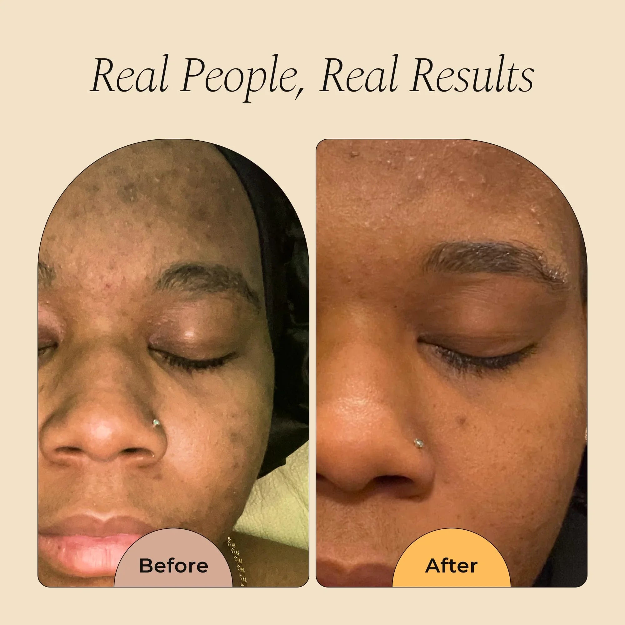 Glo Melanin Turmeric Soap for Face