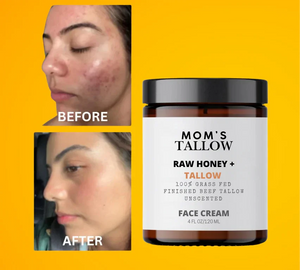 Mom’s Tallow Skin Serenity Face Cream – Nourishing Balm for Sensitive & Flaky Skin