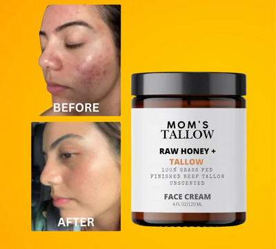 Mom’s Tallow Skin Serenity Face Cream – Nourishing Balm for Sensitive & Flaky Skin - Image 1