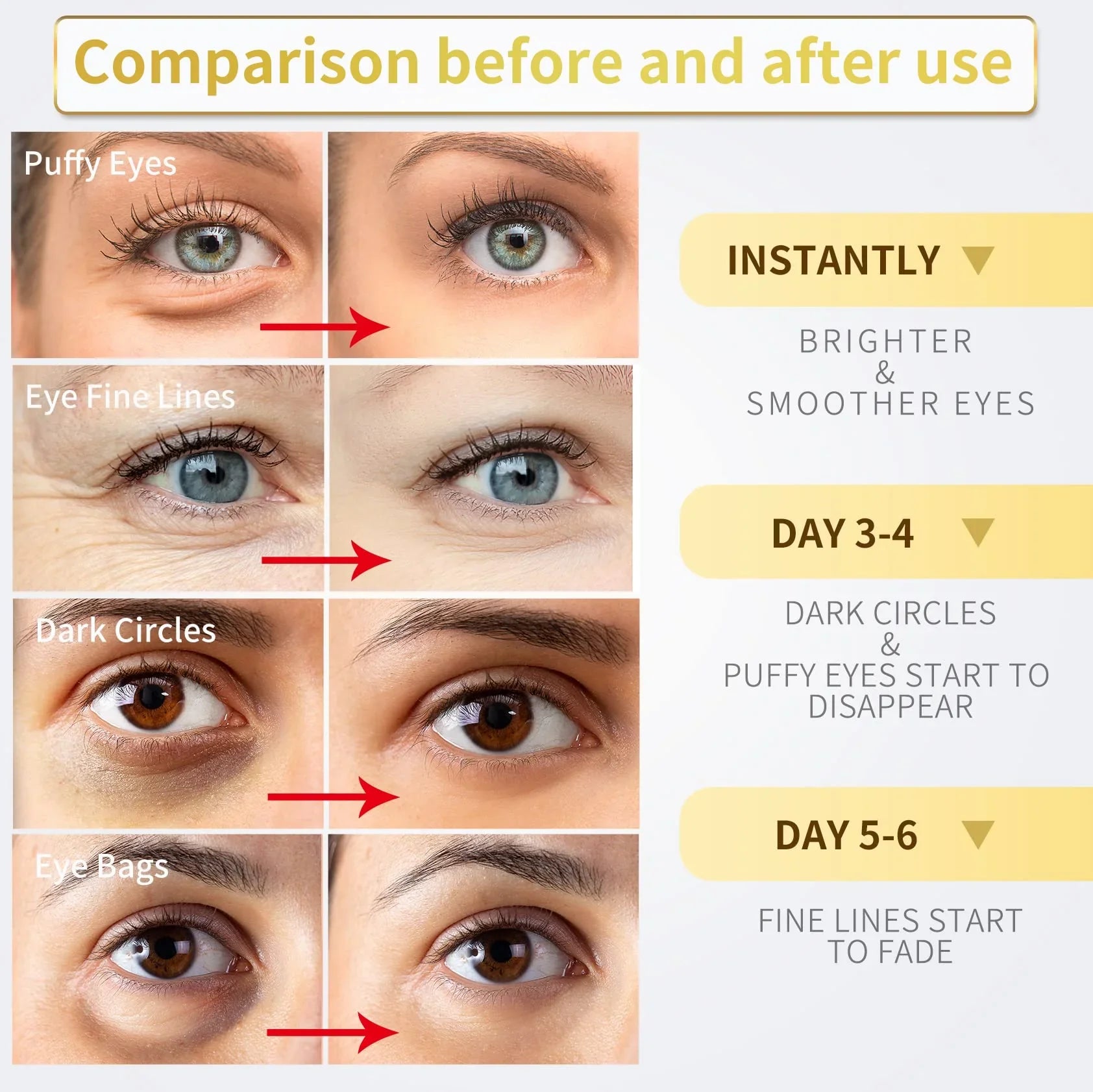 NAZANO 24K Gold Under Eye Patches - 60 Pack for Puffy Eyes