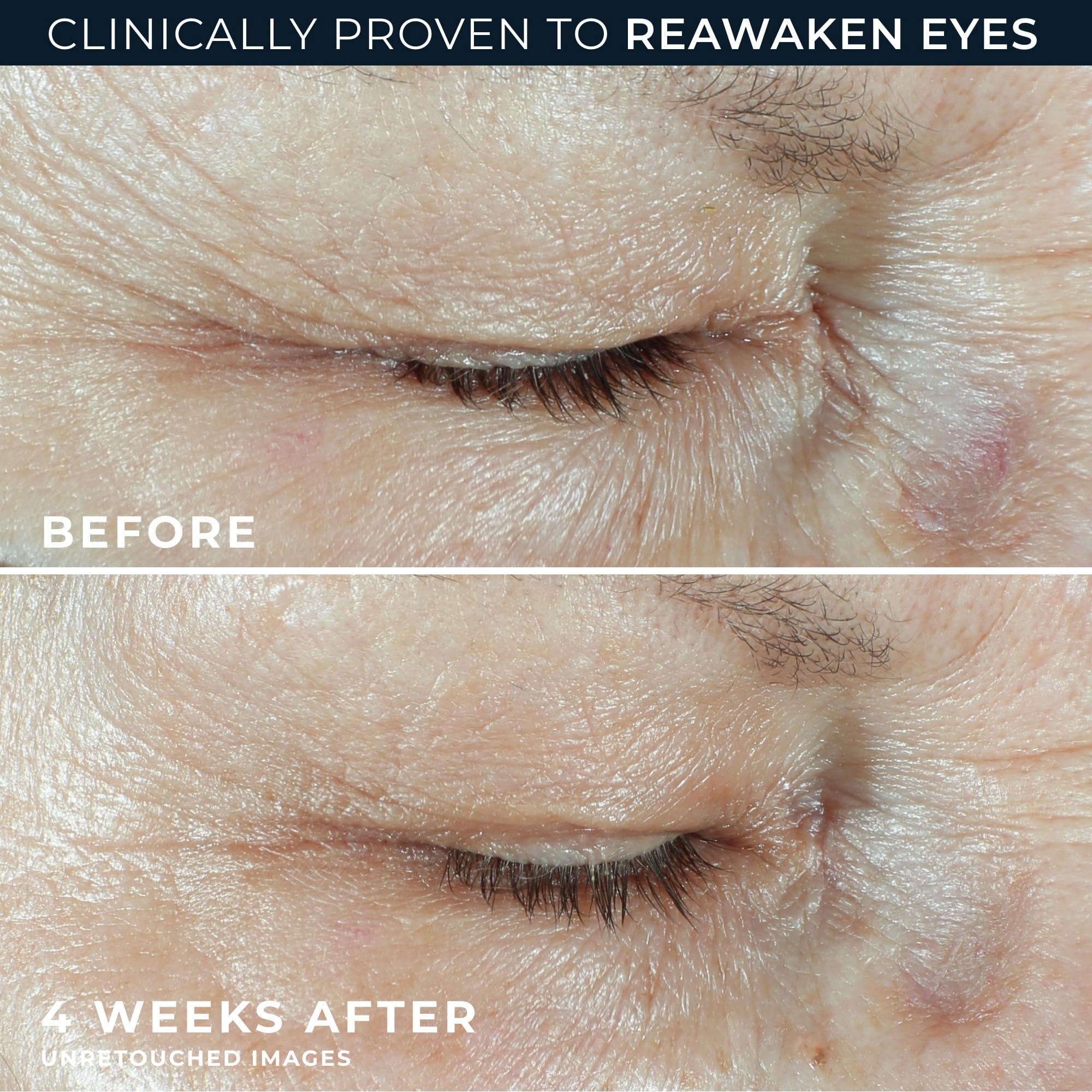 RoC Multi Correxion Hyaluronic Acid Anti Aging Under Eye Cream