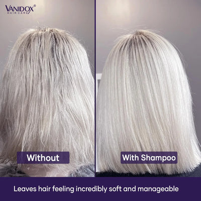 VANIDOX Purple Shampoo and Conditioner Set - Image 4
