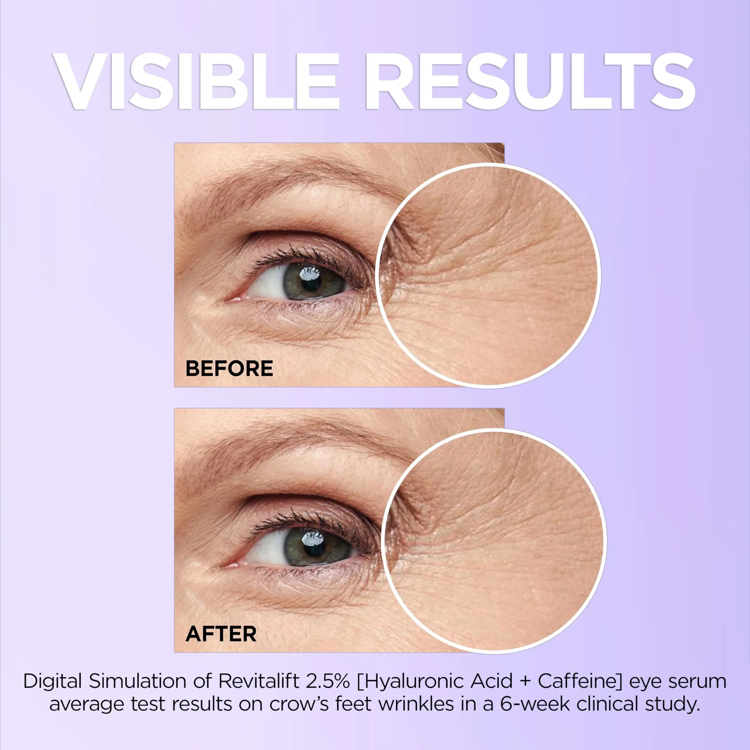 L'Oreal Paris Revitalift Hyaluronic Acid + Caffeine Hydrating Eye Serum