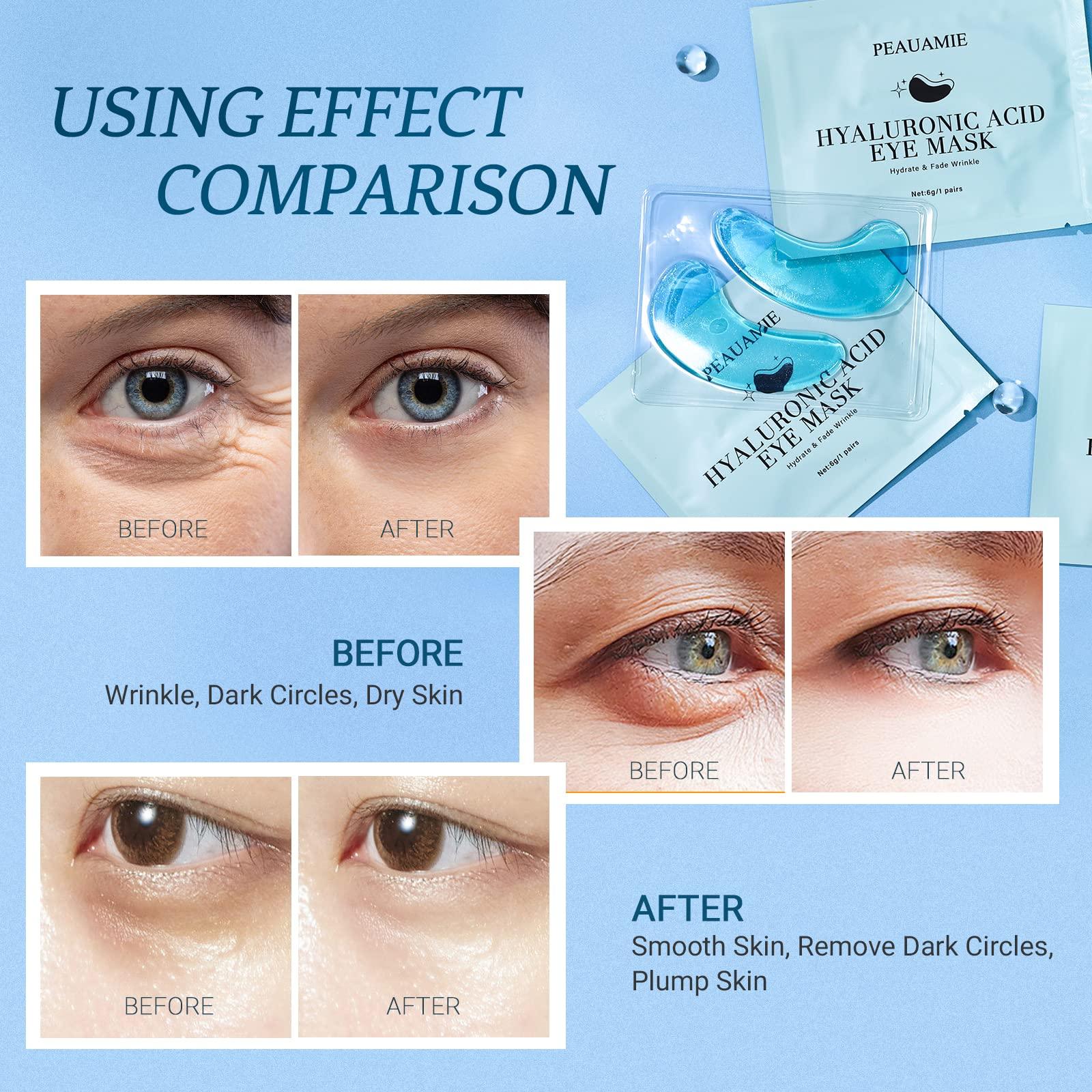 PEAUAMIE Under Eye Patches Hyaluronic Acid Eye Mask 30 Pairs
