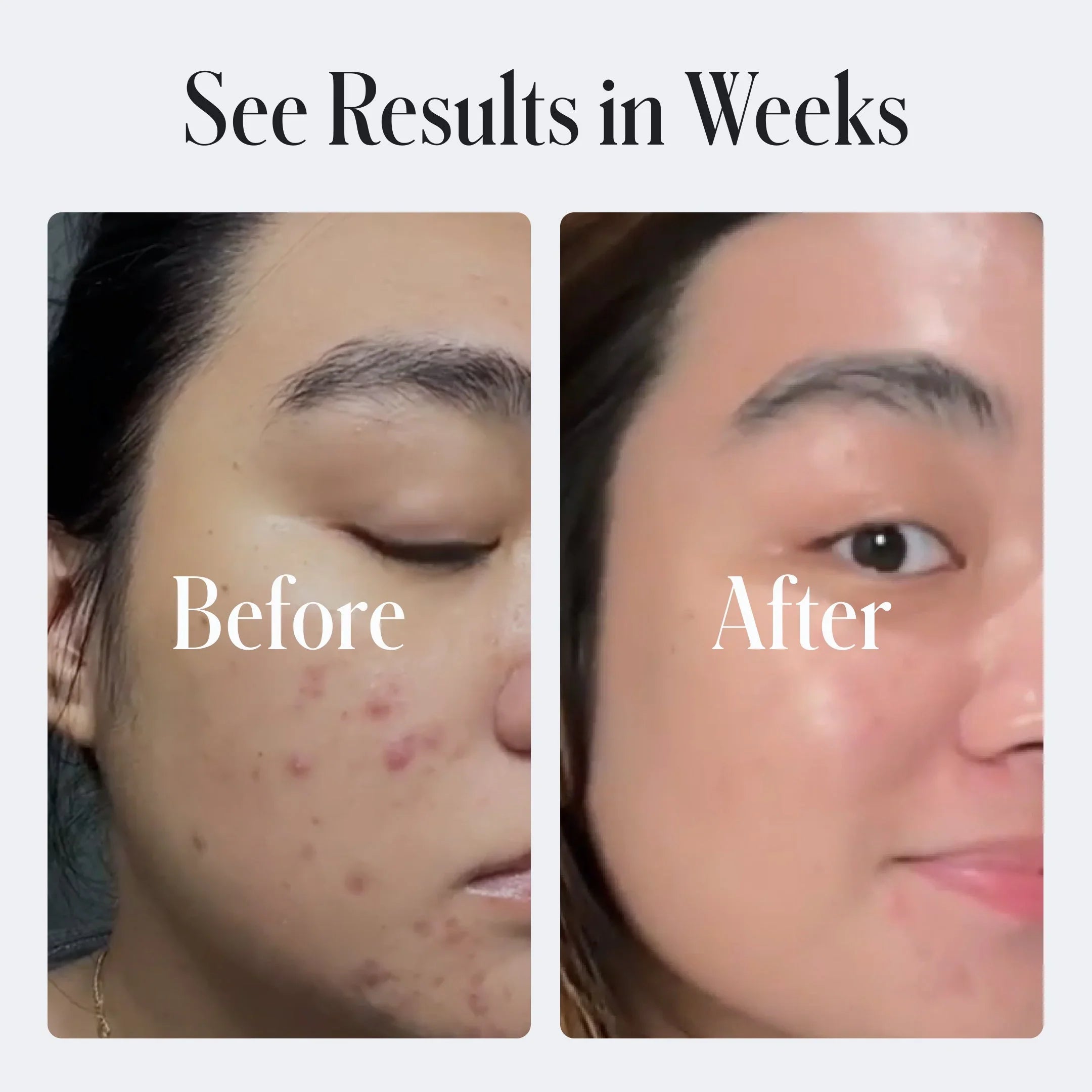Geologie Acne Control Body Wash