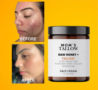 Mom’s Tallow Skin Serenity Face Cream – Nourishing Balm for Sensitive & Flaky Skin - Image 2