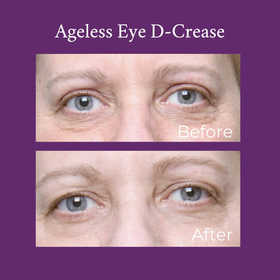 PRAI Beauty Ageless Eye D-Crease - Image 3