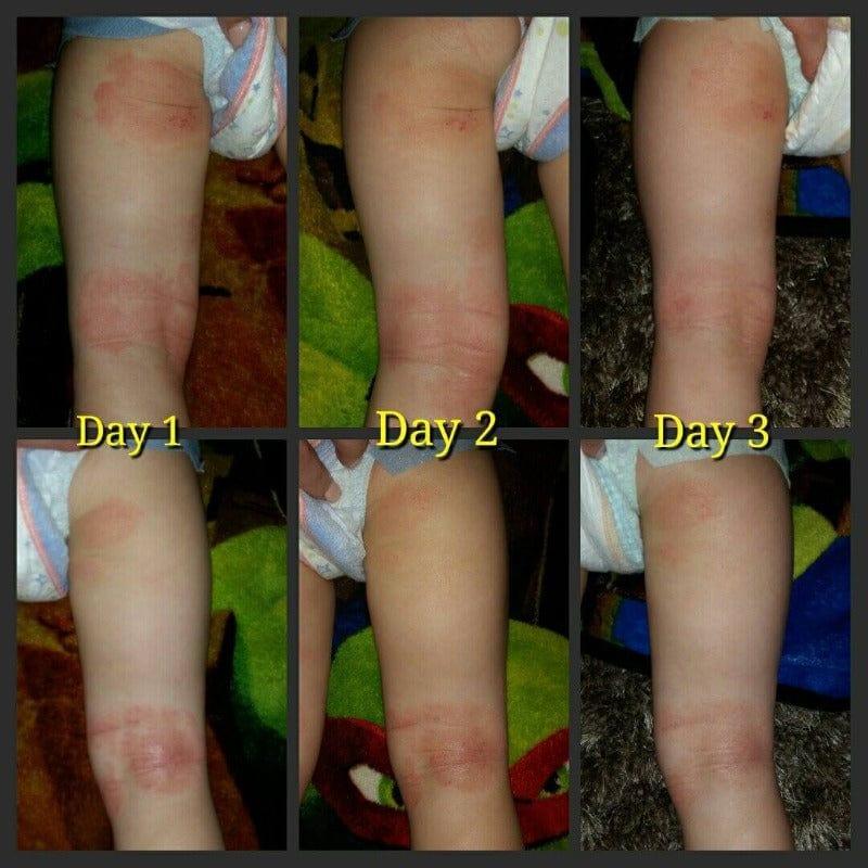 Emu Joy SOOTHE MY SKIN EMU OIL CREAM – Nature’s Healing Power Unleashed!