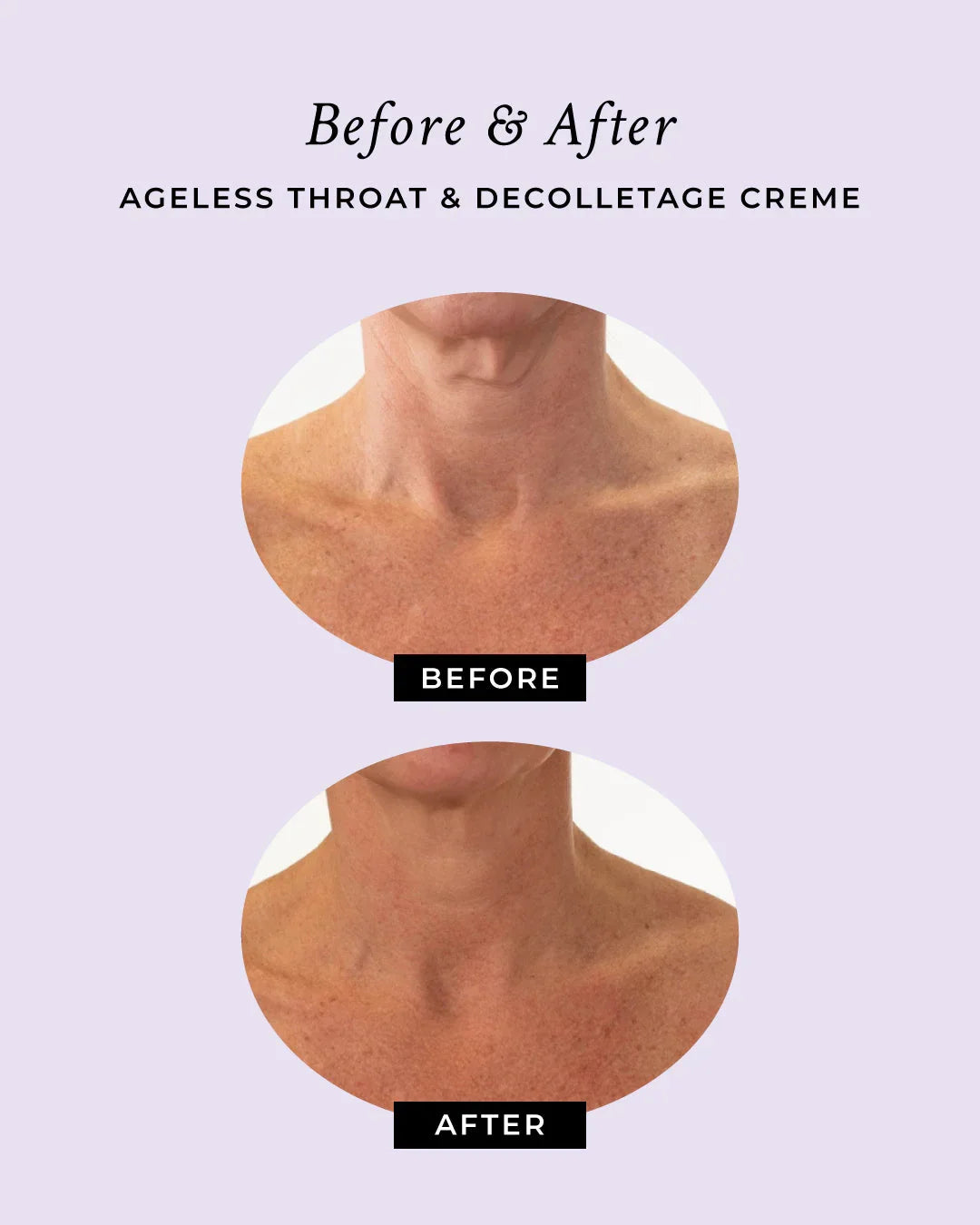 PRAI Beauty Ageless Throat & Decolletage Anti-Aging Neck Creme