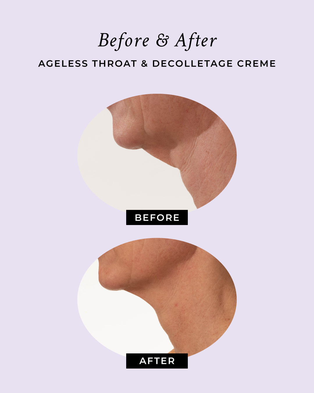 PRAI Beauty Ageless Throat & Decolletage Anti-Aging Neck Creme