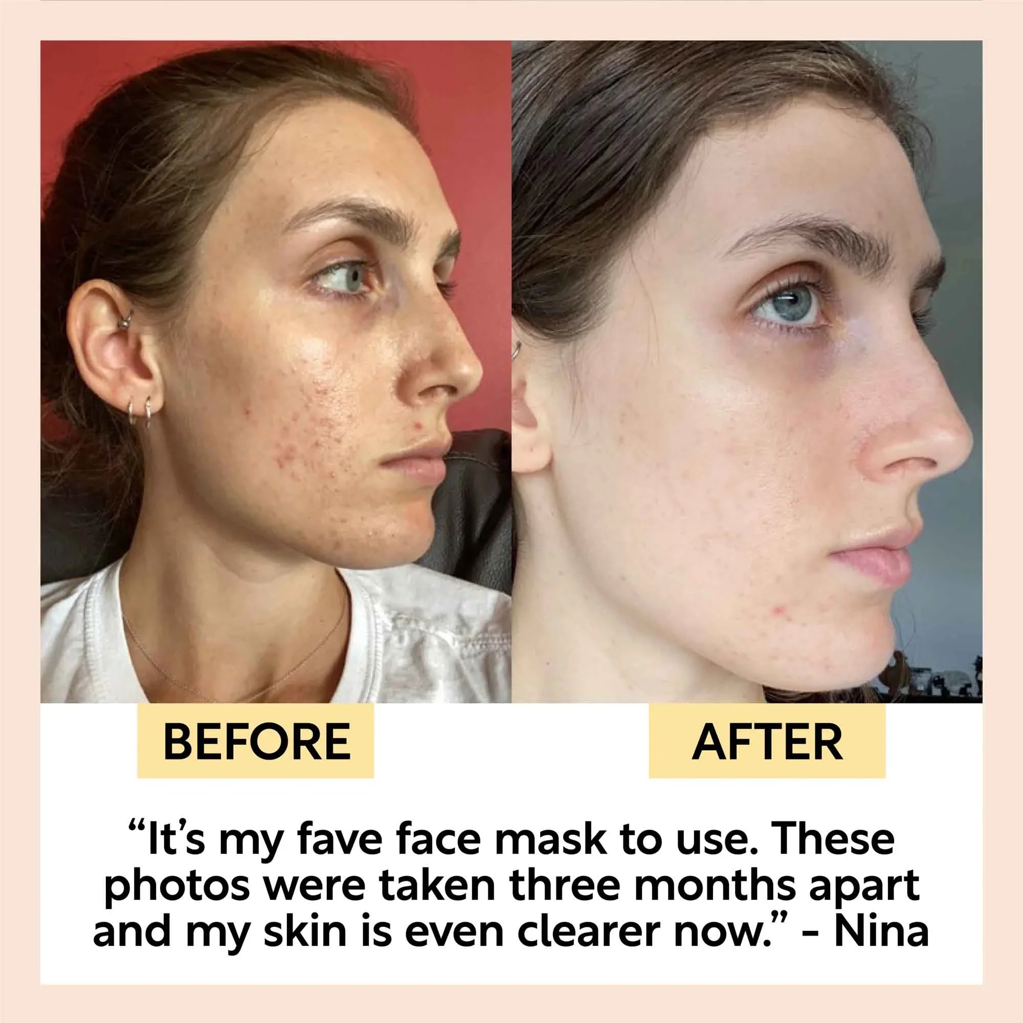 UpCircle Kaolin Clay Face Mask