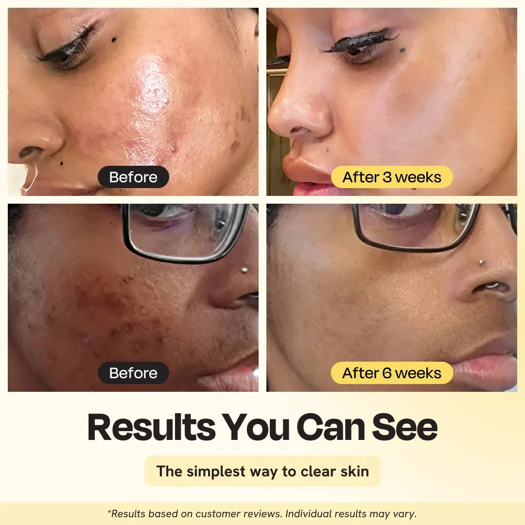 Gleamin Jumbo Vitamin C Clay Mask