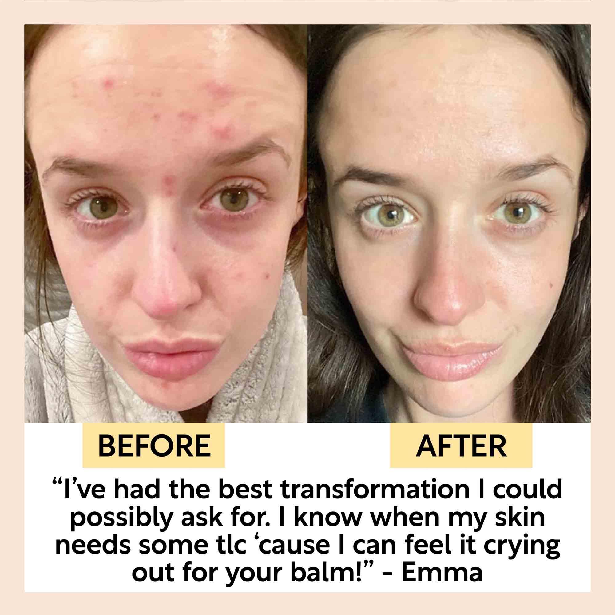 UpCircle Cleansing Face Balm with Oat Oil + Vitamin E - Travel Size