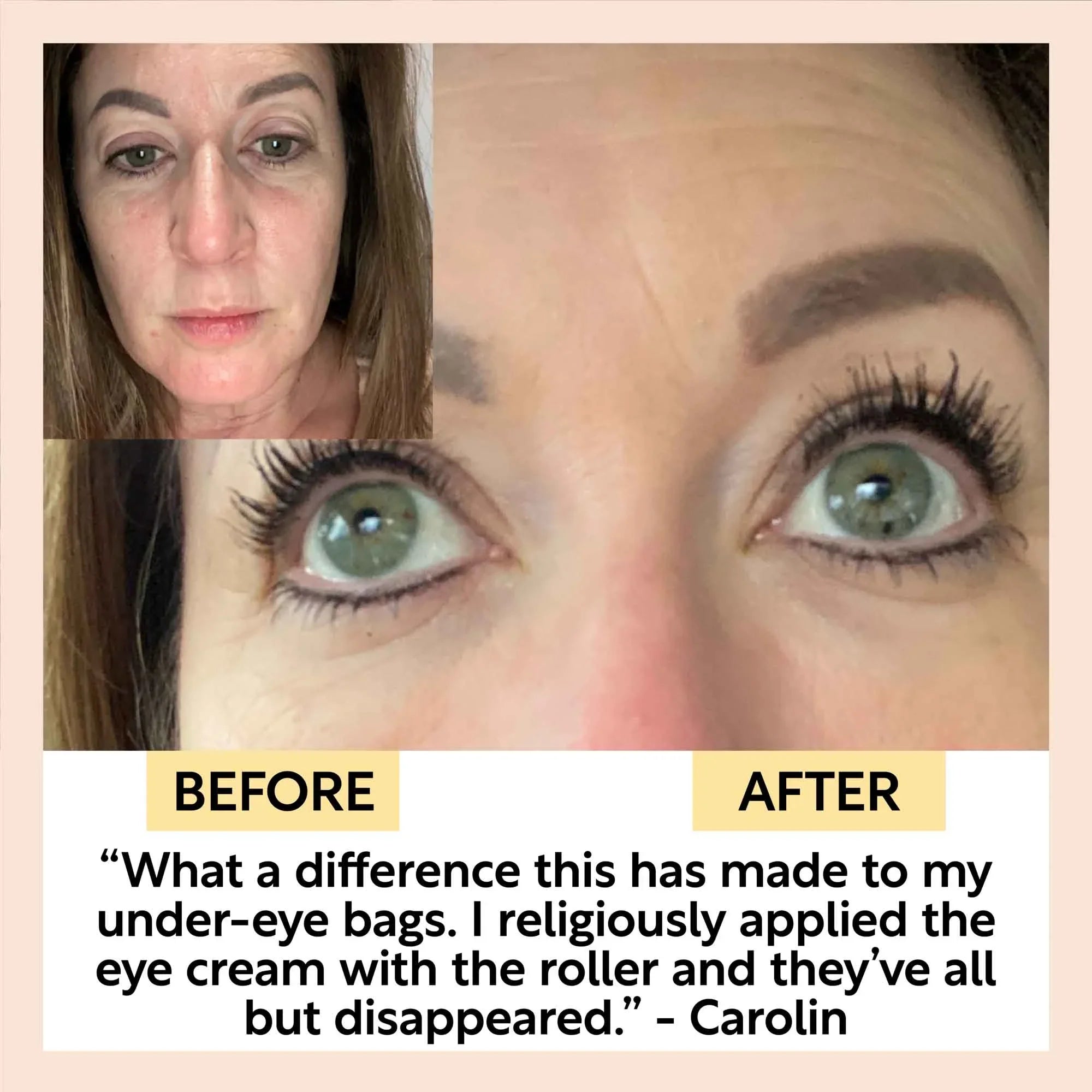 UpCircle The Caffeinated Duo + Eye Roller Deal