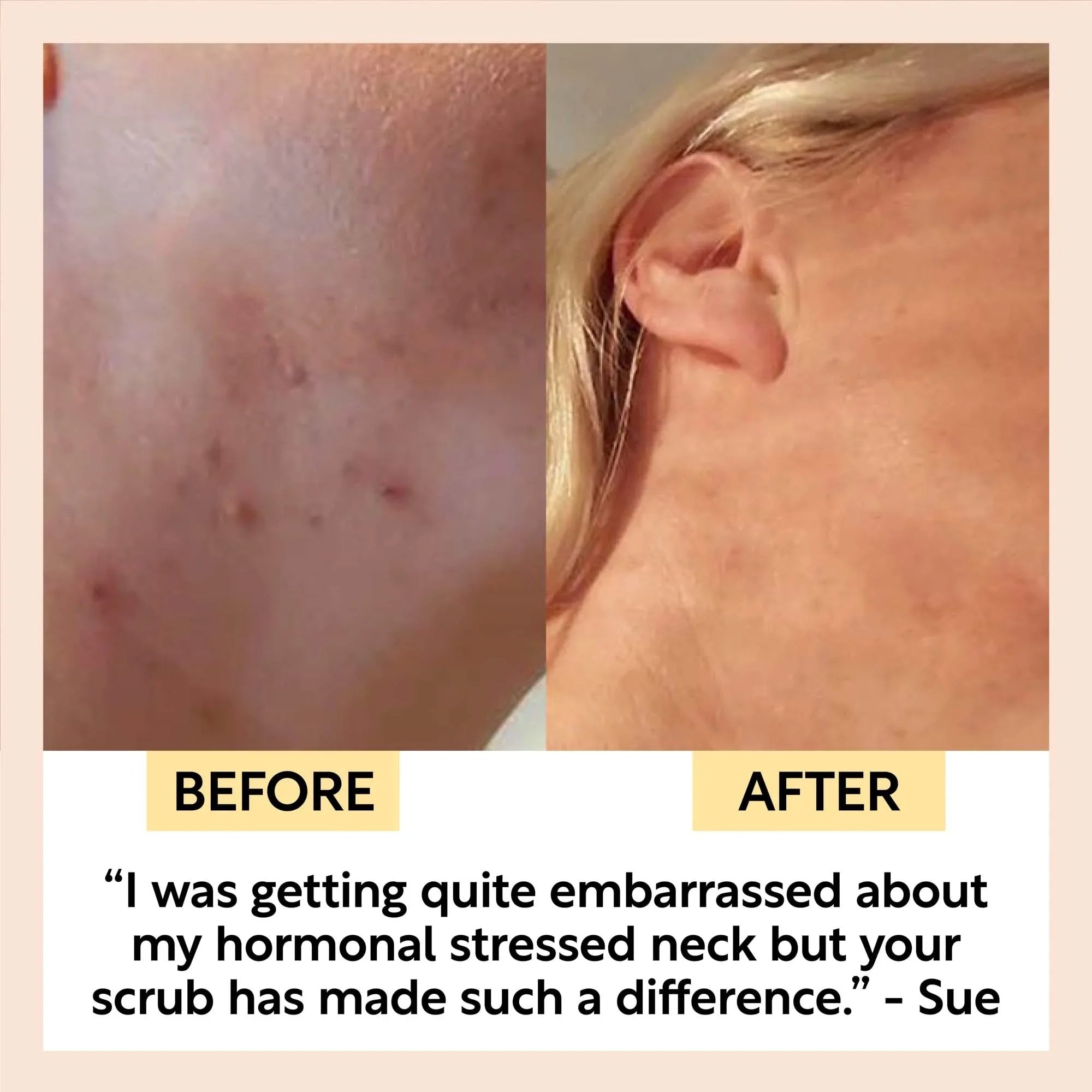 UpCircle Natural Face Scrub – Citrus Blend – Travel Size