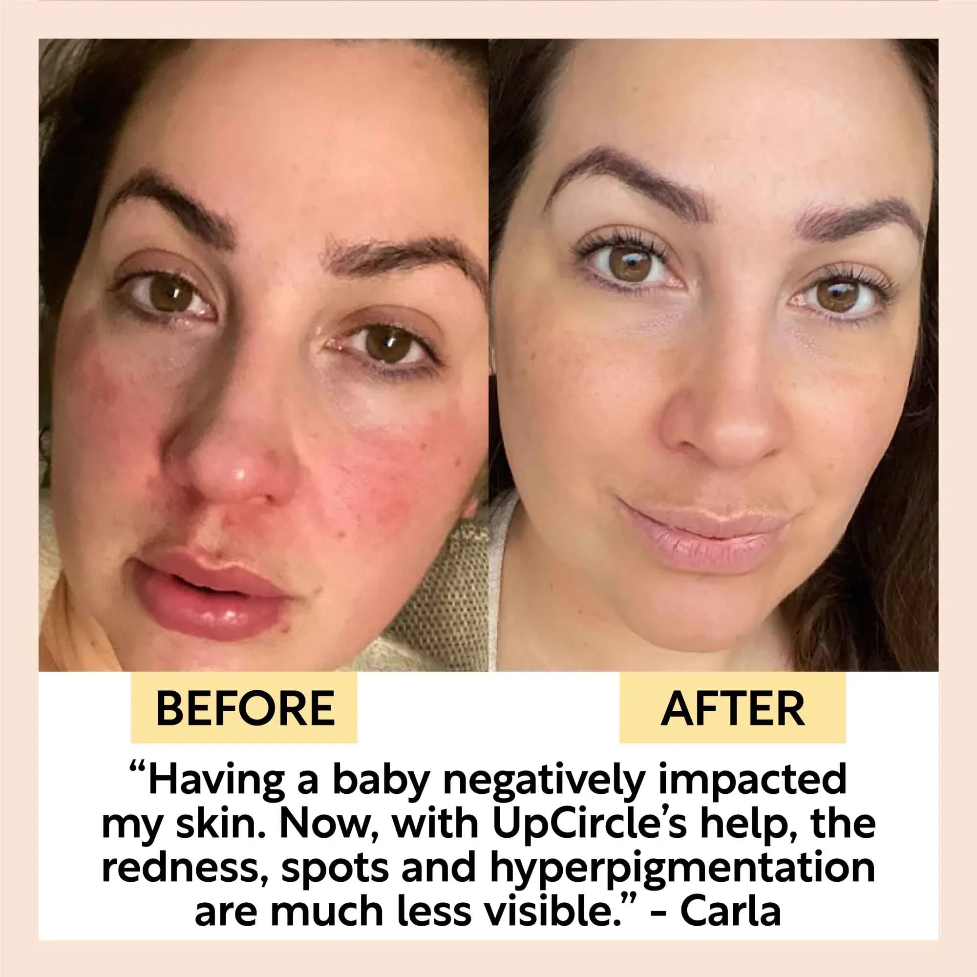 UpCircle Day + Night Hydration Set