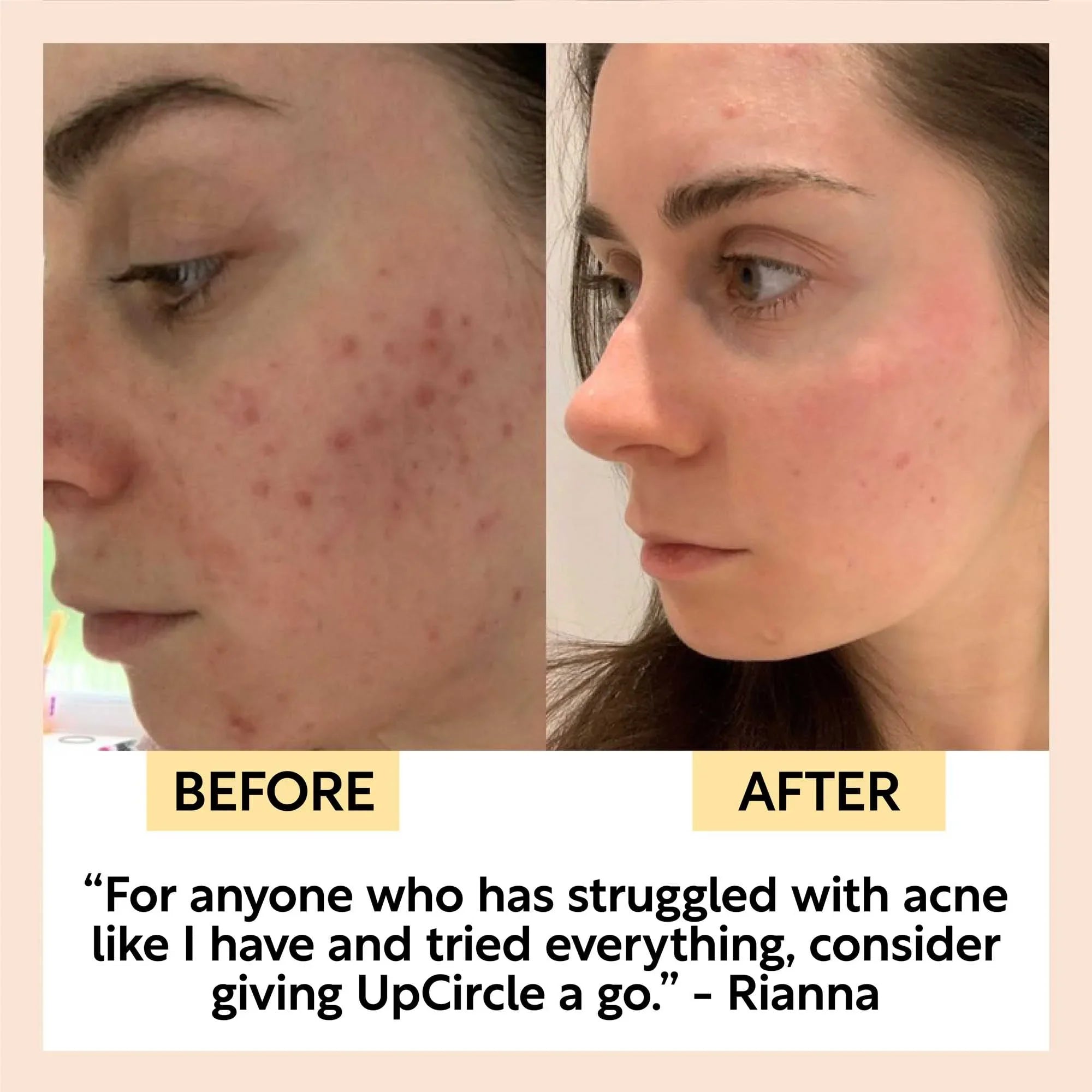UpCircle Face Toner with Hyaluronic Acid - Travel Size
