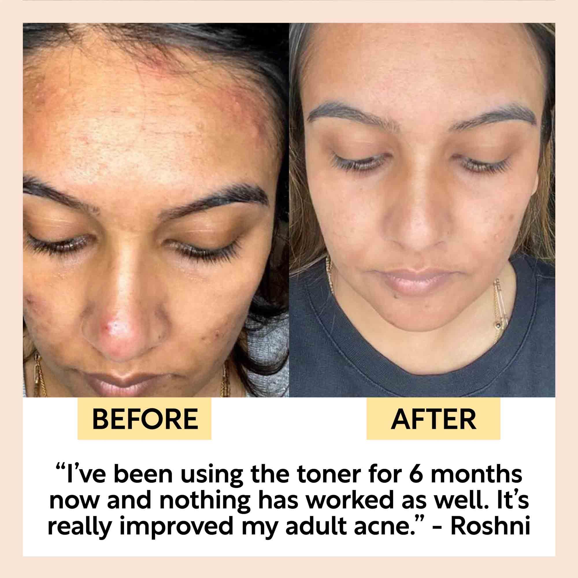 UpCircle Face Toner with Hyaluronic Acid - Travel Size