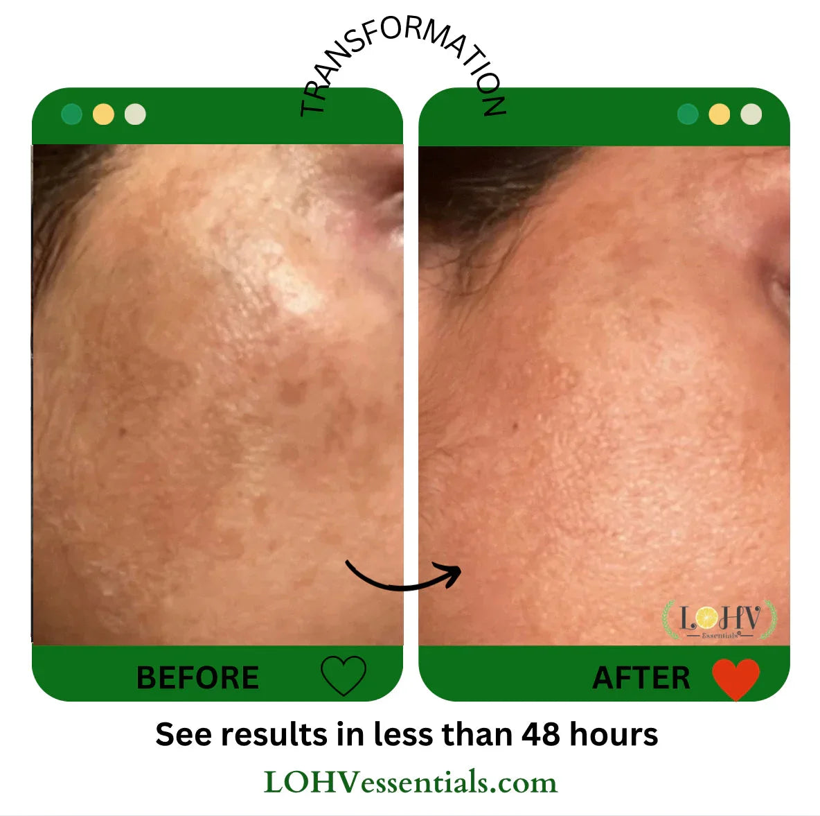 LOHV ESSENTIALS PREMIUM 100% VEGAN GLOW UP Toner Serum With Hyaluronic Acid