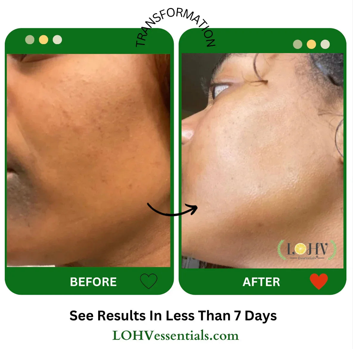 LOHV ESSENTIALS PREMIUM 100% VEGAN GLOW UP Toner Serum With Hyaluronic Acid