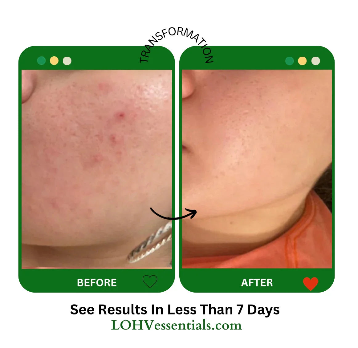 LOHV ESSENTIALS PREMIUM 100% Vegan Hydrating Facial Cleanser