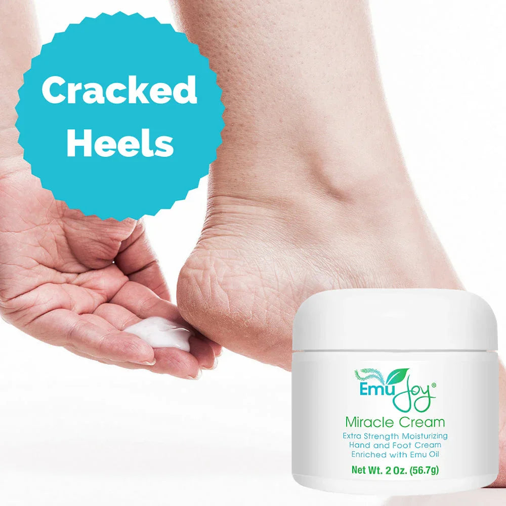 Emu Joy Miracle Cream (f.k.a., Banish My Callus)