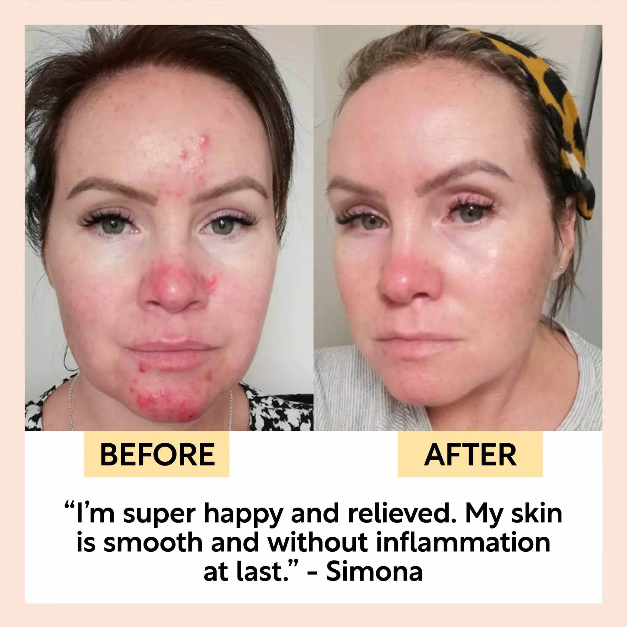 UpCircle Day + Night Hydration Set