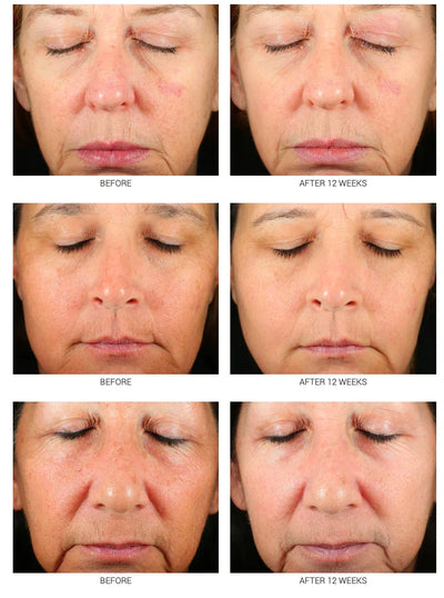 Accelerated Aesthetics Advanced WRI-LAX 5x - Image 4
