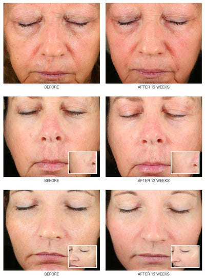 Accelerated Aesthetics Advanced WRI-LAX 5x - Image 3